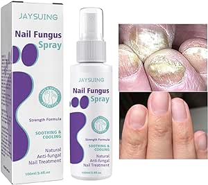 Nail Fungus Spray